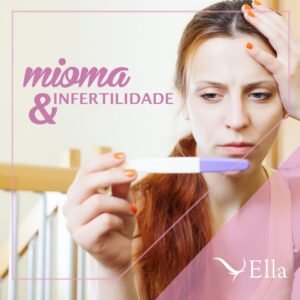 Read more about the article Mioma e infertilidade