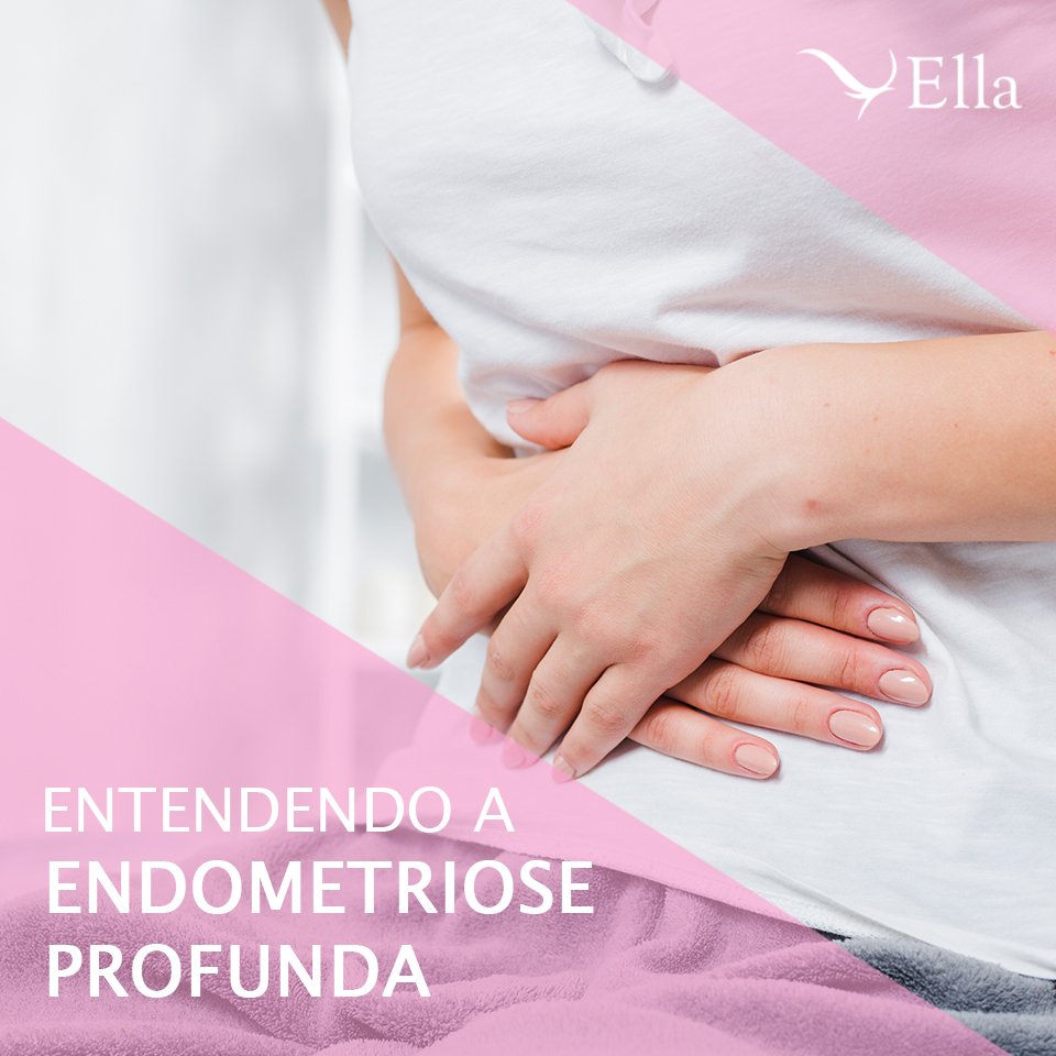 Você está visualizando atualmente Entendendo a endometriose profunda