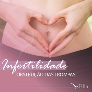 Leia mais sobre o artigo Infertilidade: obstrução das trompas